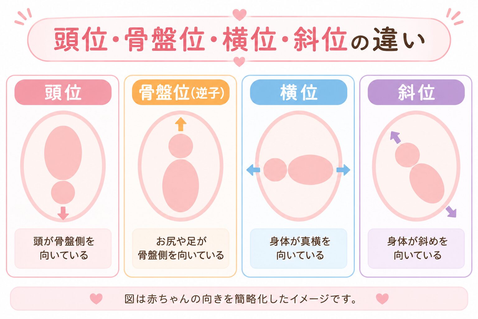 赤ちゃんの向きの違い図解